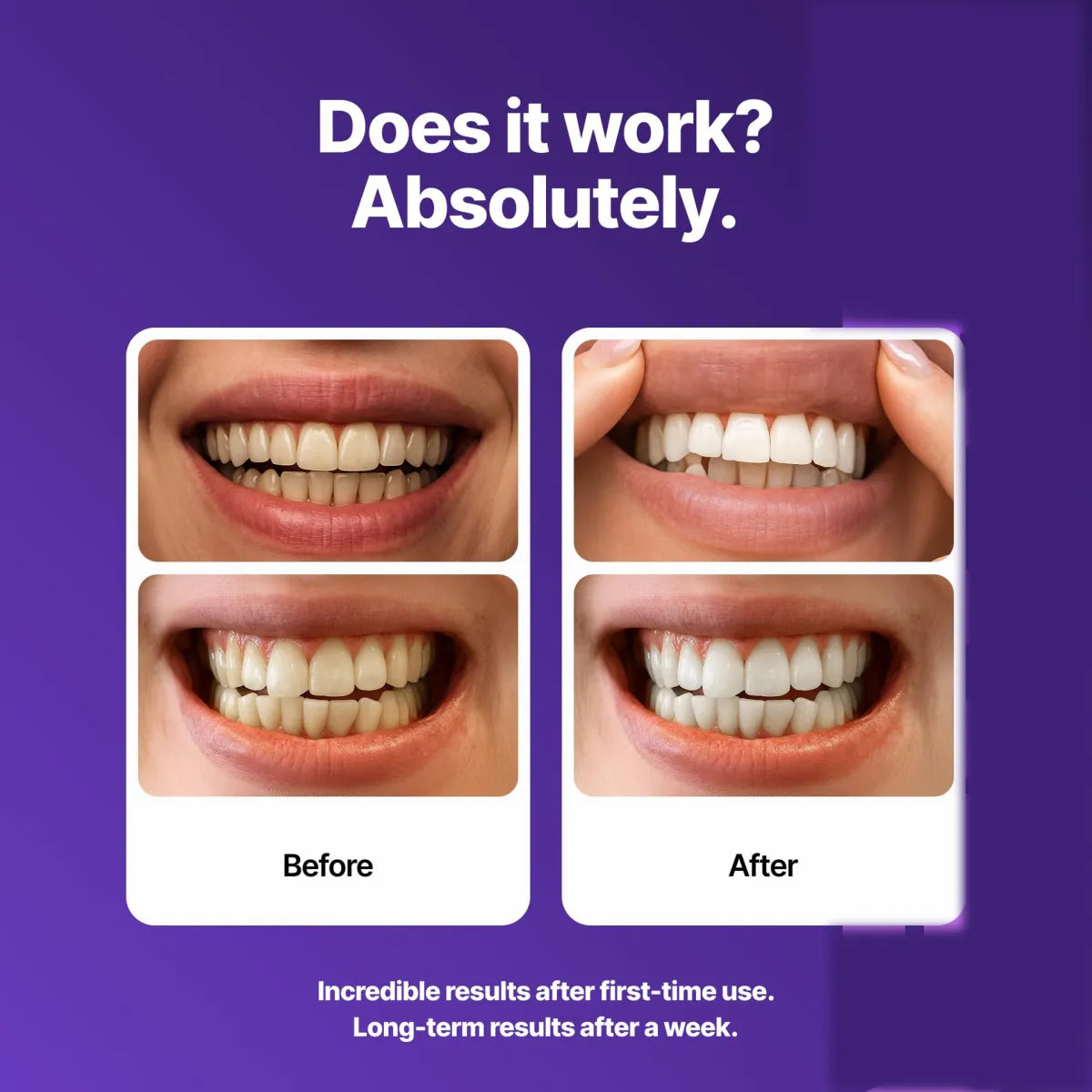 Purple Teeth Whitening